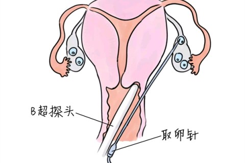 http://chongqing.vdtfzz.com/post/205.html|重庆供卵助孕