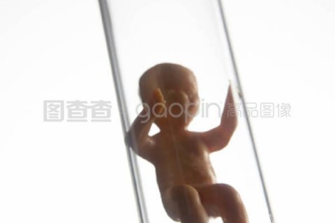 http://chongqing.vdtfzz.com/post/197.html|重庆试管助孕